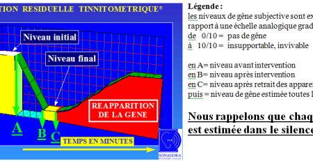 Inhibition résiduelle tinnitométrique